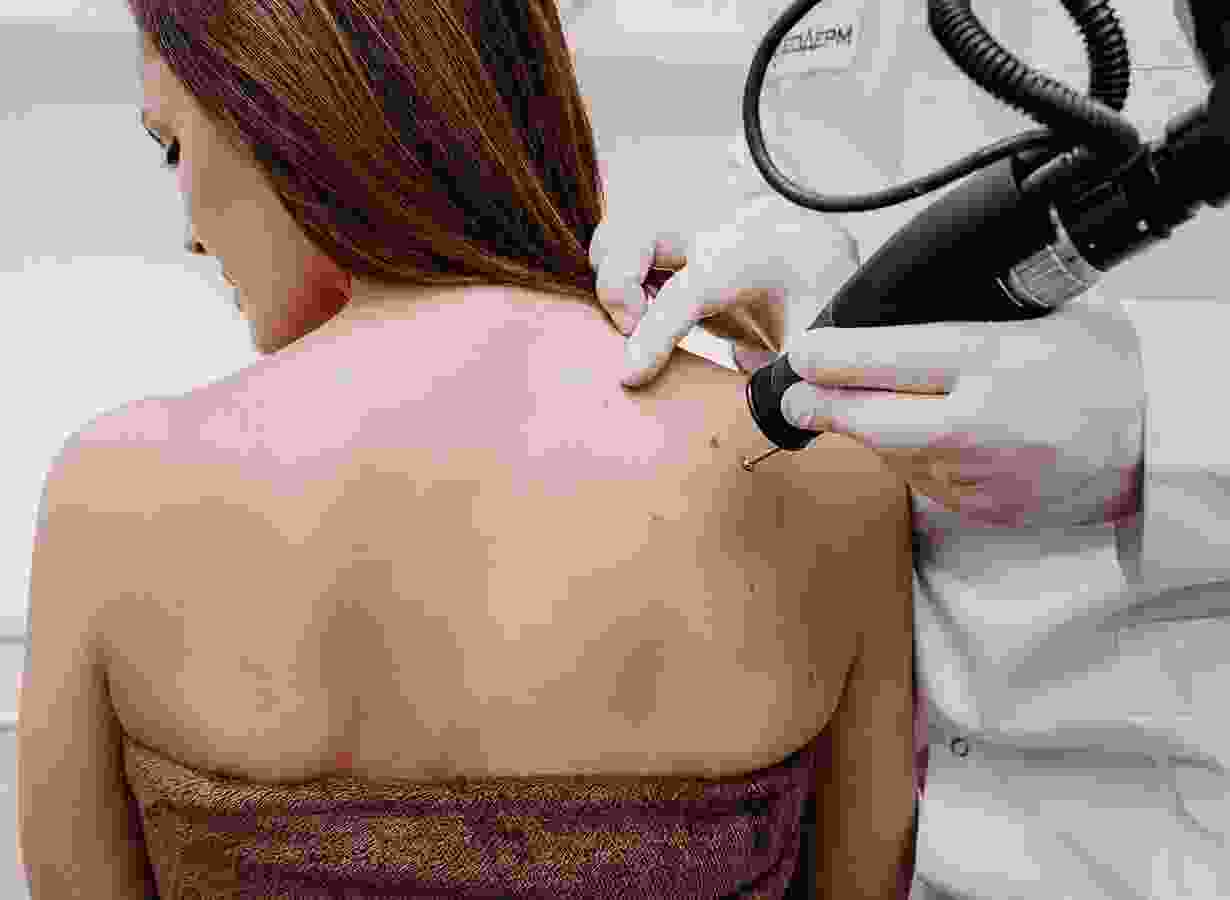 A woman getting her back shaved off by a doctor.